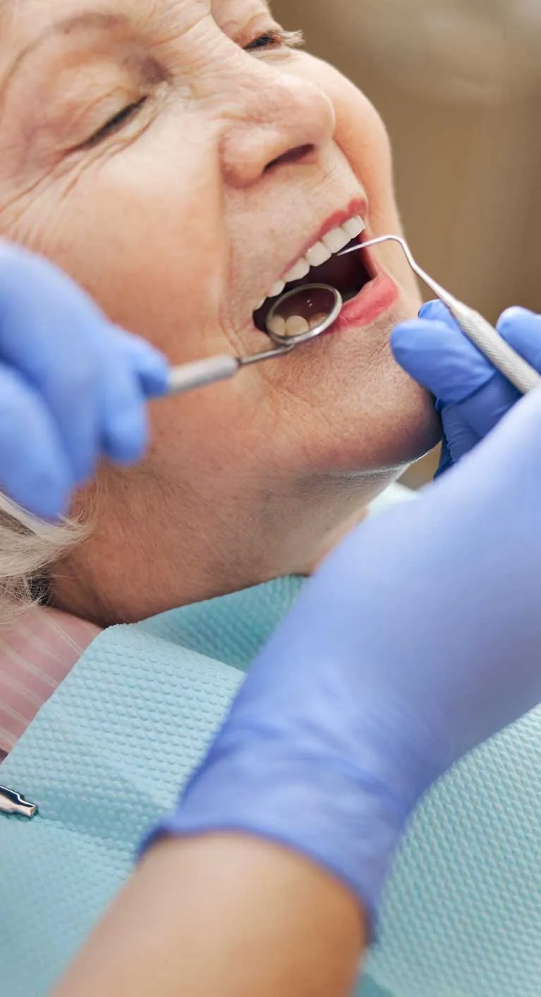 Implantes dentales