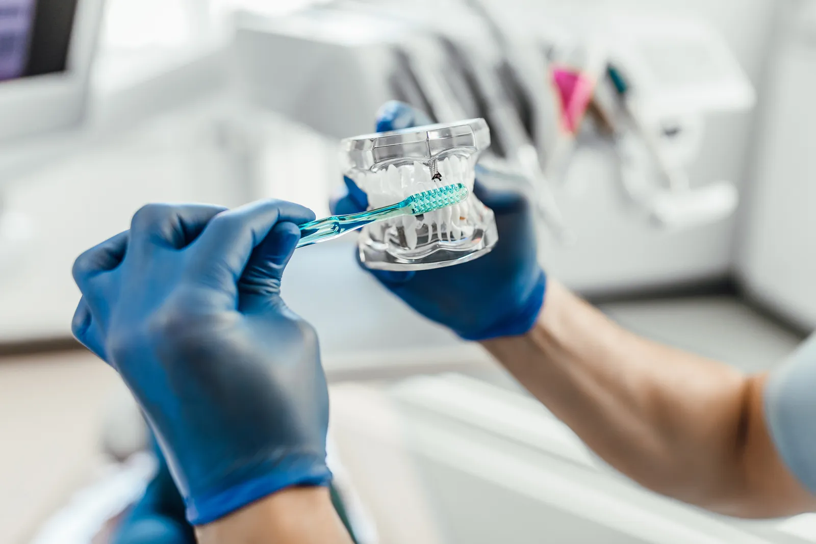 Implantes dentales